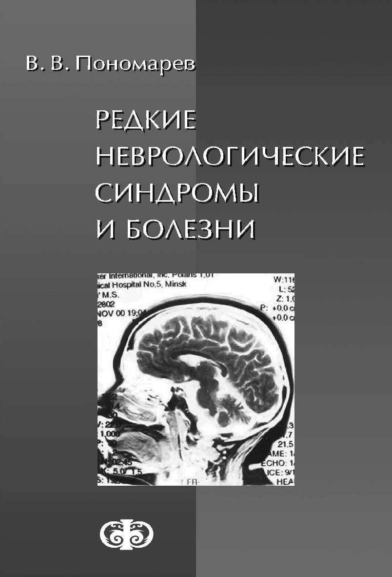 Редкие неврологические синдромы и болезни (наблюдения из практики) : руководство для врачей ISBN 5-93929-116-3