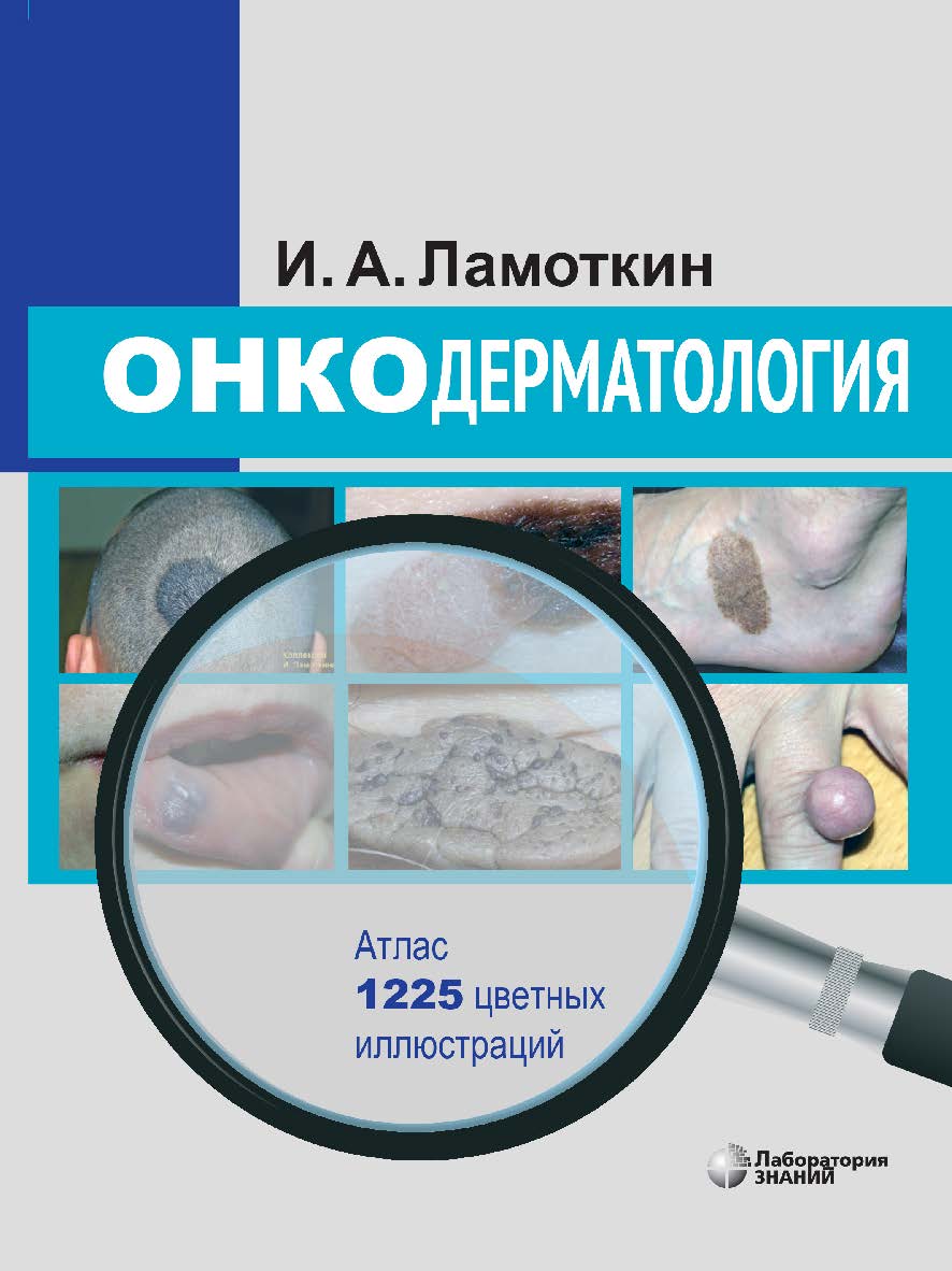 Онкодерматология : атлас : учебное пособие. — 2-е изд., электрон. ISBN 978-5-93208-556-1