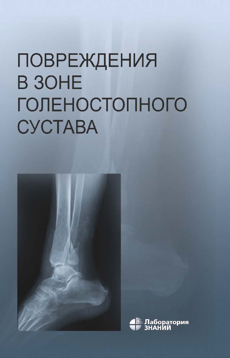 Повреждения в зоне голеностопного сустава : атлас. — 5-е изд., электрон. ISBN 978-5-93208-811-1