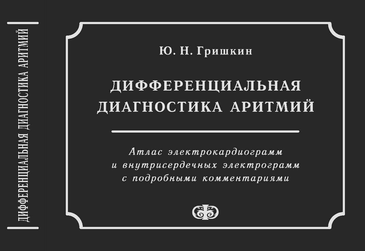 Дифференциальная диагностика аритмий (атлас электрокардиограмм и внутрисердечных электрограмм с подробными комментариями). — 2-е изд., испр. и доп. ISBN 978-5-93929-175-0