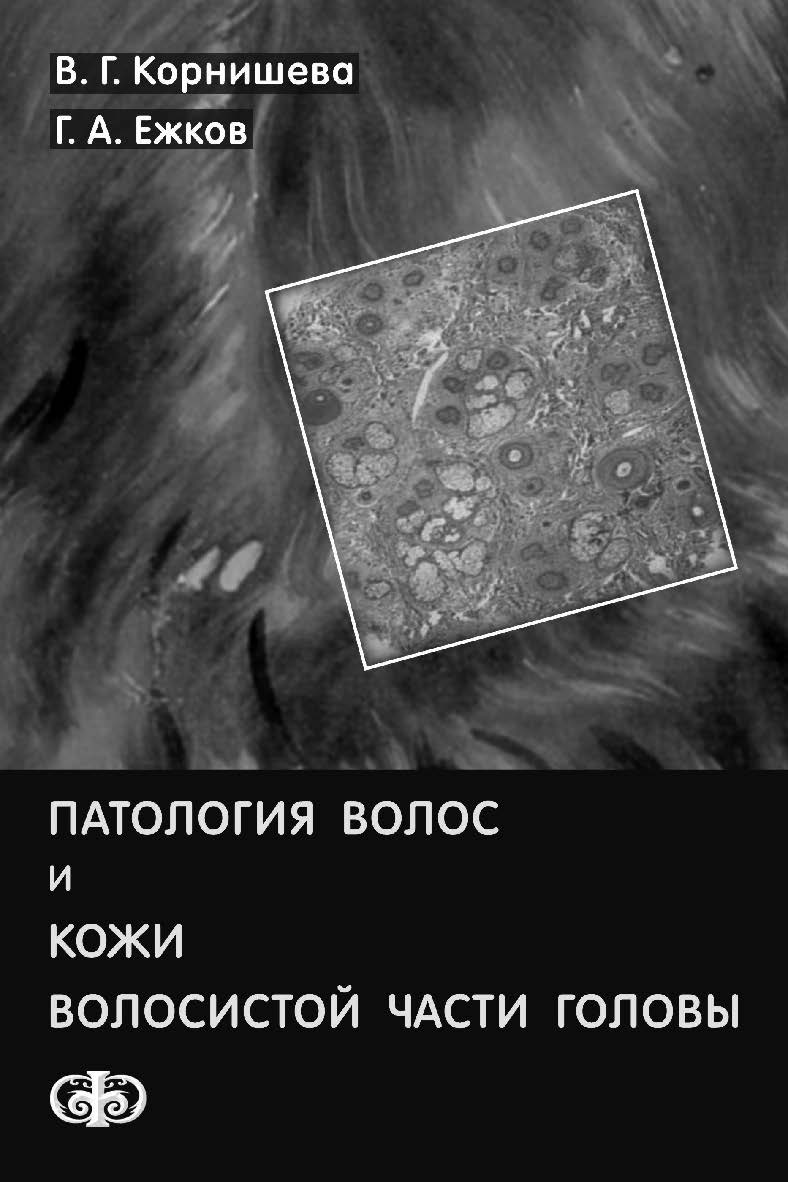 Патология волос и кожи волосистой части головы ISBN 978-5-93929-222-1