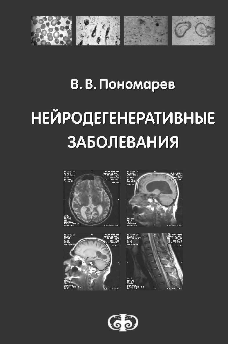 Нейродегенеративные заболевания : Руководство для врачей ISBN 978-5-93929-236-8