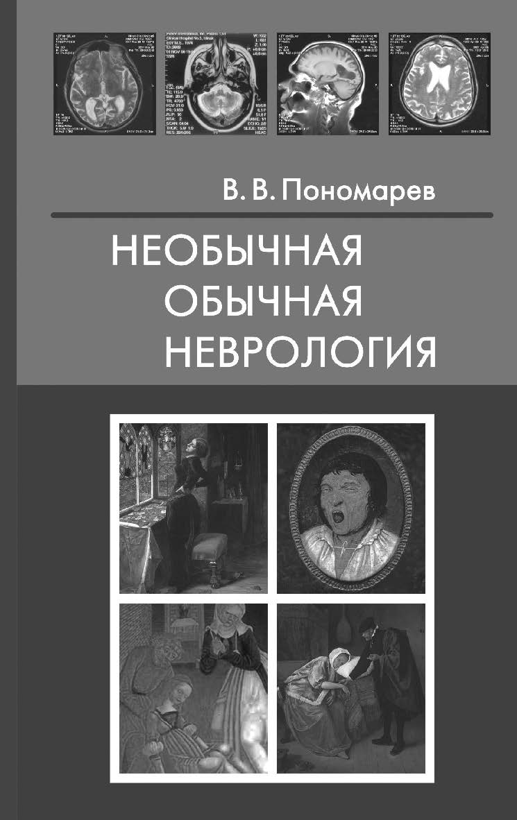 Необычная обычная неврология : Руководство для врачей ISBN 978-5-93929-286-3