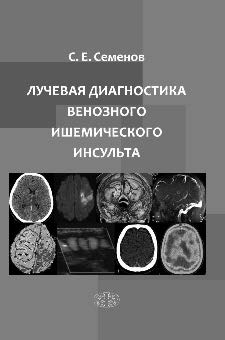 Лучевая диагностика венозного ишемического инсульта ISBN 978-5-93929-289-4