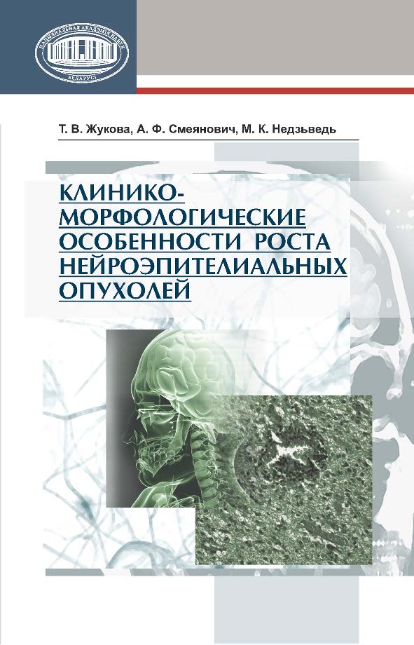 Клинико-морфологические особенности роста нейроэпителиальных опухолей ISBN 978-985-08-1583-5