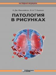 Патология в рисунках / пер. с англ.— 3-е изд., электрон. — (Наглядная медицина) ISBN 978-5-93208-583-7